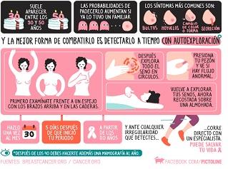 Pasos de la Autoexploración en el Cáncer de Mama