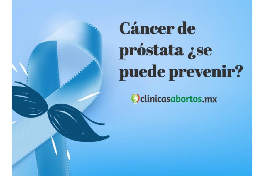 Cáncer de próstata ¿se puede prevenir?