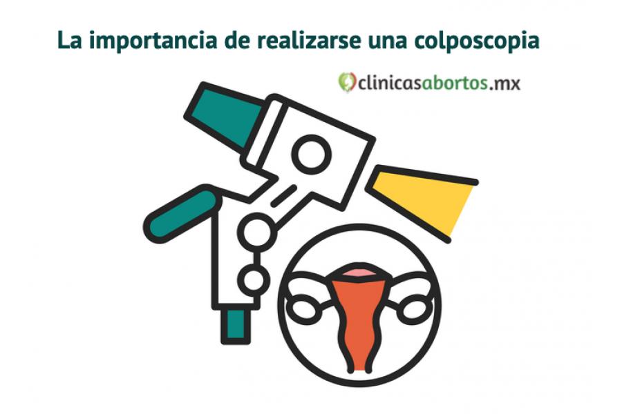 La importancia de realizarse una colposcopia