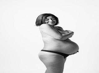 Diabetes y obesidad, peligros frecuentes para las embarazadas mexicanas